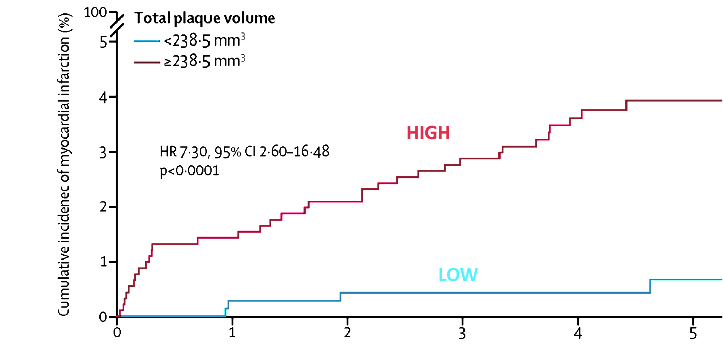 Autoplaque chart